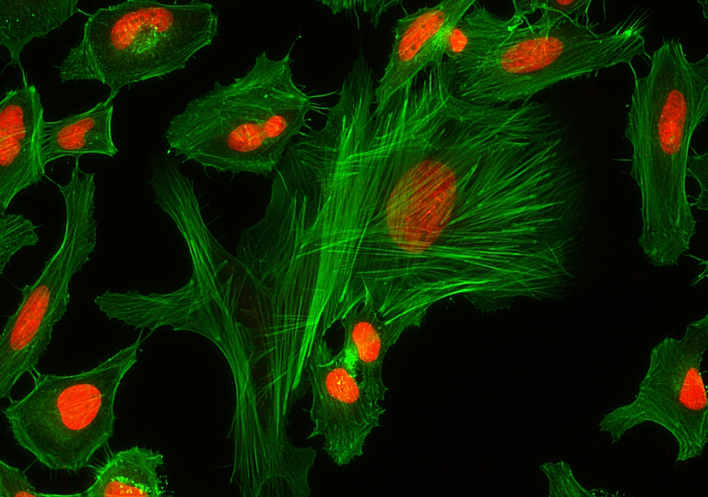 af488 phalloidin equivalent to alexa fluor 488 phalloidin alexa 488