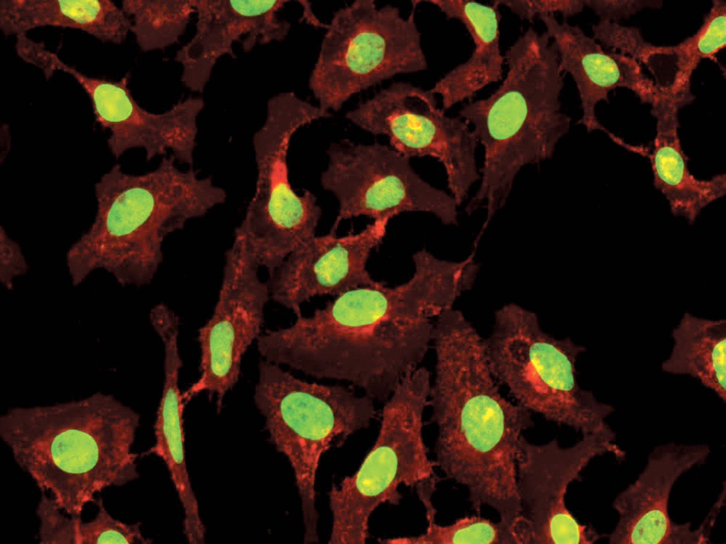 Cell Navigator® Cell Plasma Membrane Staining Kit *Orange