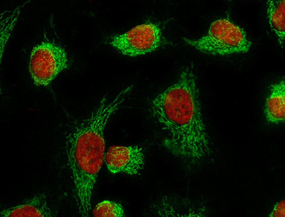 ボール NUCLEAR CELL Nuclear expansion and pore opening are instant signs of