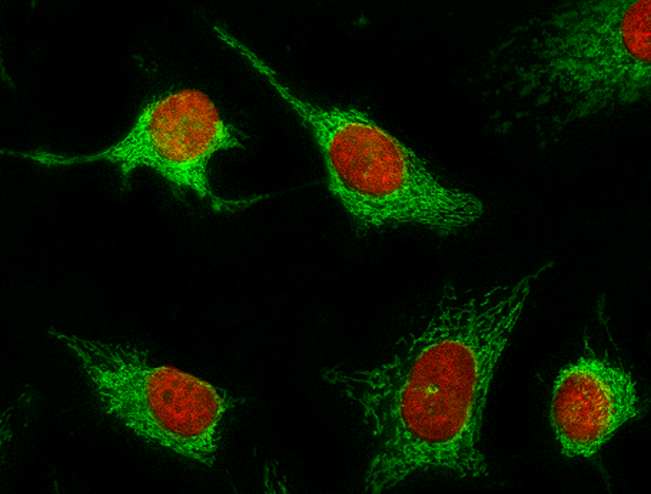 Nuclear Red™ LCS1 *5 mM DMSO Solution* | AAT Bioquest