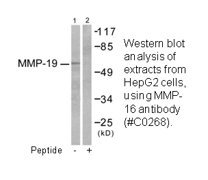 MMP16 Antibody AAT Bioquest