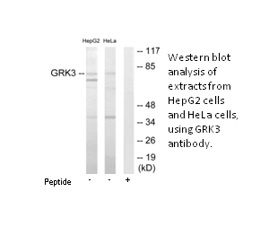 GRK3 Antibody | AAT Bioquest