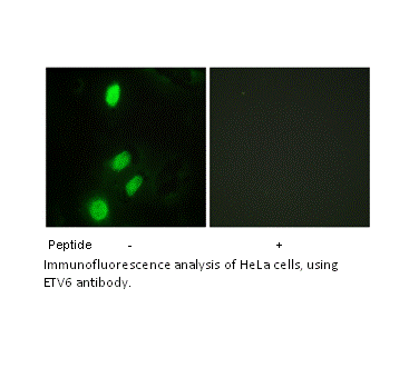 ETV6 Antibody AAT Bioquest