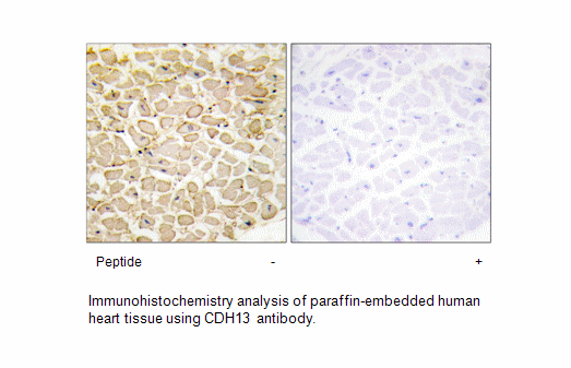 CDH13 Antibody | AAT Bioquest