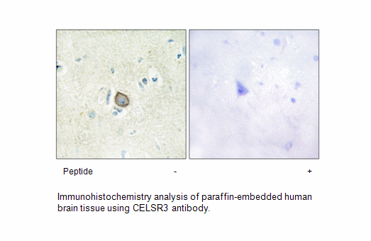 CELSR3 Antibody AAT Bioquest