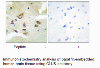 CLUS Antibody AAT Bioquest
