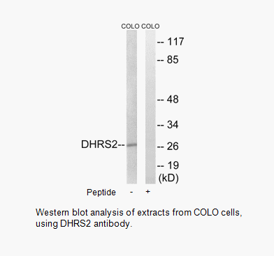 DHRS2 Antibody | AAT Bioquest