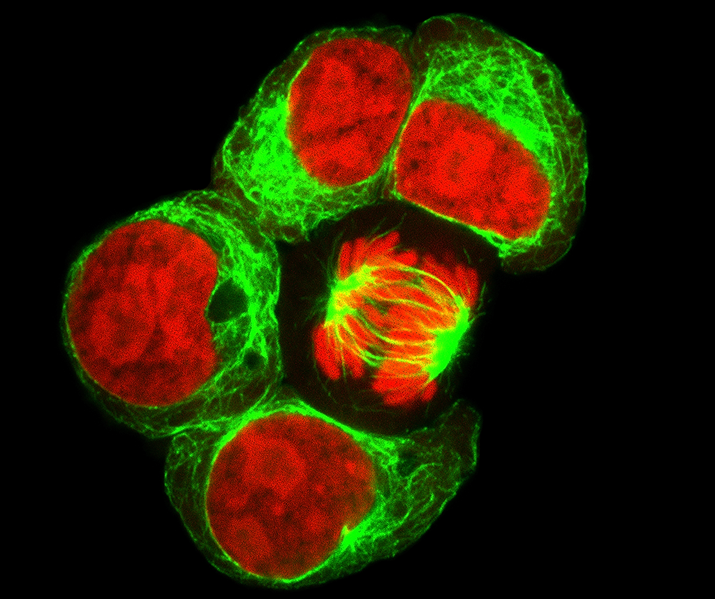 Fluorescence Microscopy